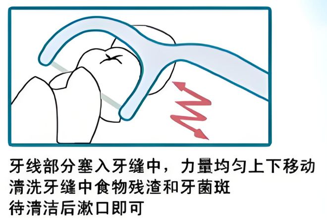 卫生习惯--小鹿妈妈牙线J9数字平台年夜饭后的(图2)