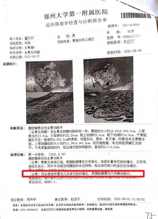 生竟按胃癌晚期切除全胃事发郑州详情曝出j9九游会真人第一品牌老汉患慢性胃炎医(图3)