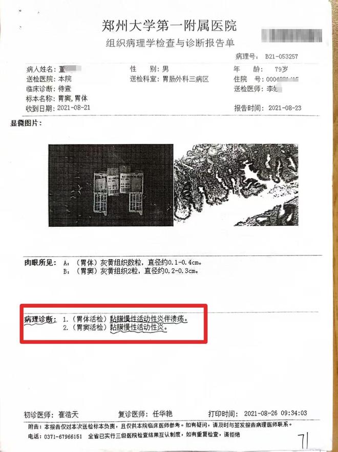 生竟按胃癌晚期切除全胃事发郑州详情曝出j9九游会真人第一品牌老汉患慢性胃炎医(图7)